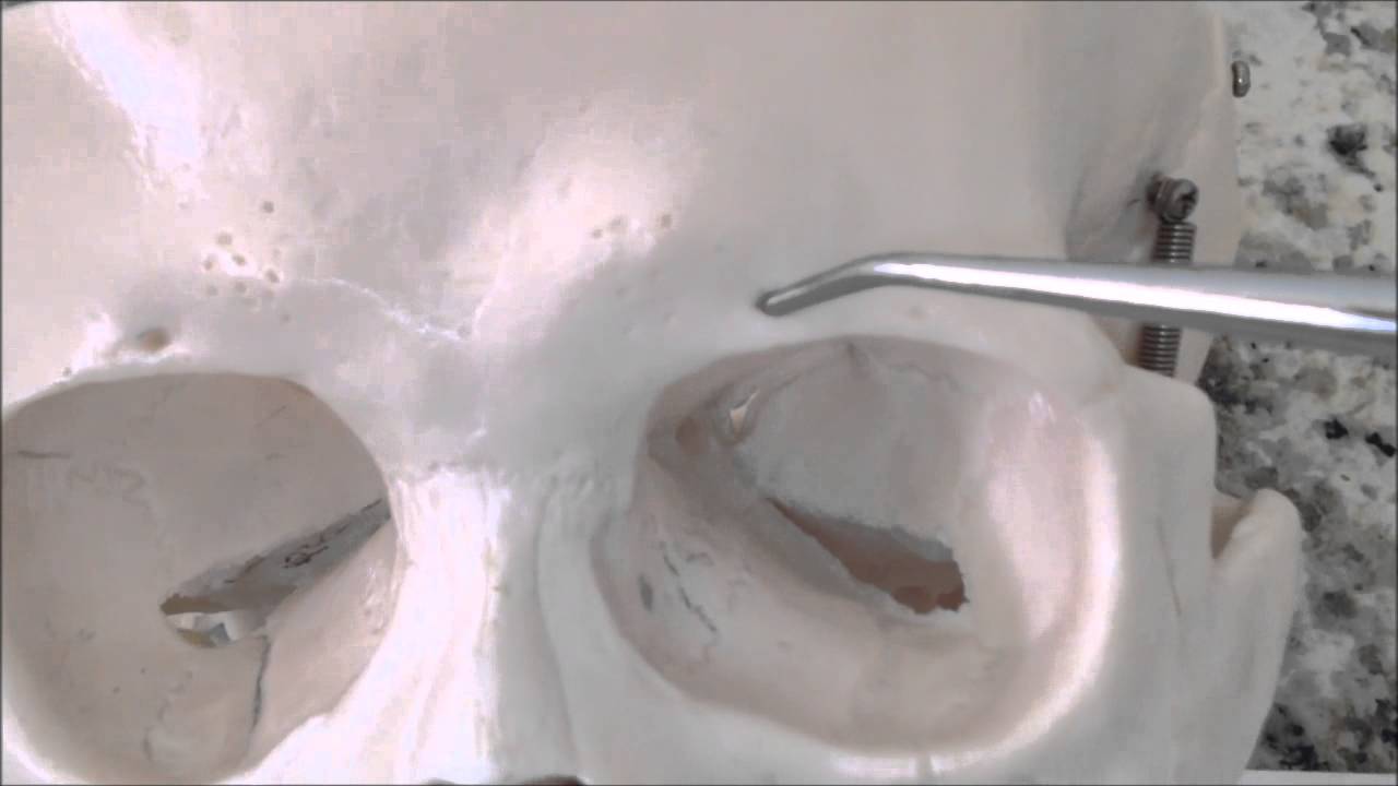 Supraorbital Foramen