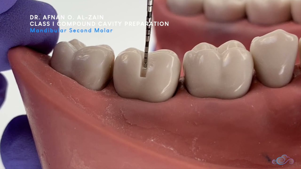 Class I compound cavity preparation - mandibular molar - Preclinical Operative - Arabic عربي