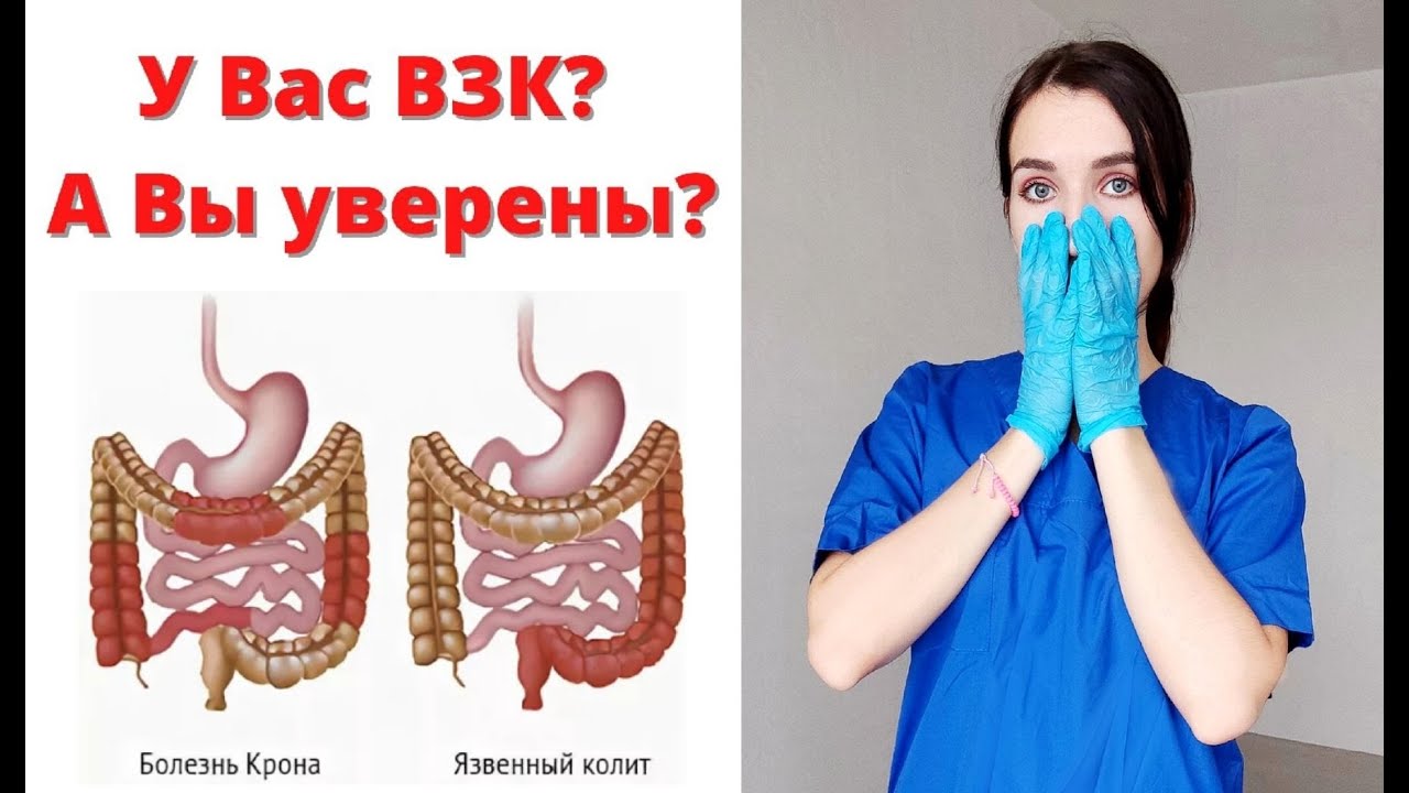 КАК ДИАГНОСТИРОВАТЬ Болезнь КРОНА и ЯЗВЕННЫЙ КОЛИТ ❓ Личный опыт врача