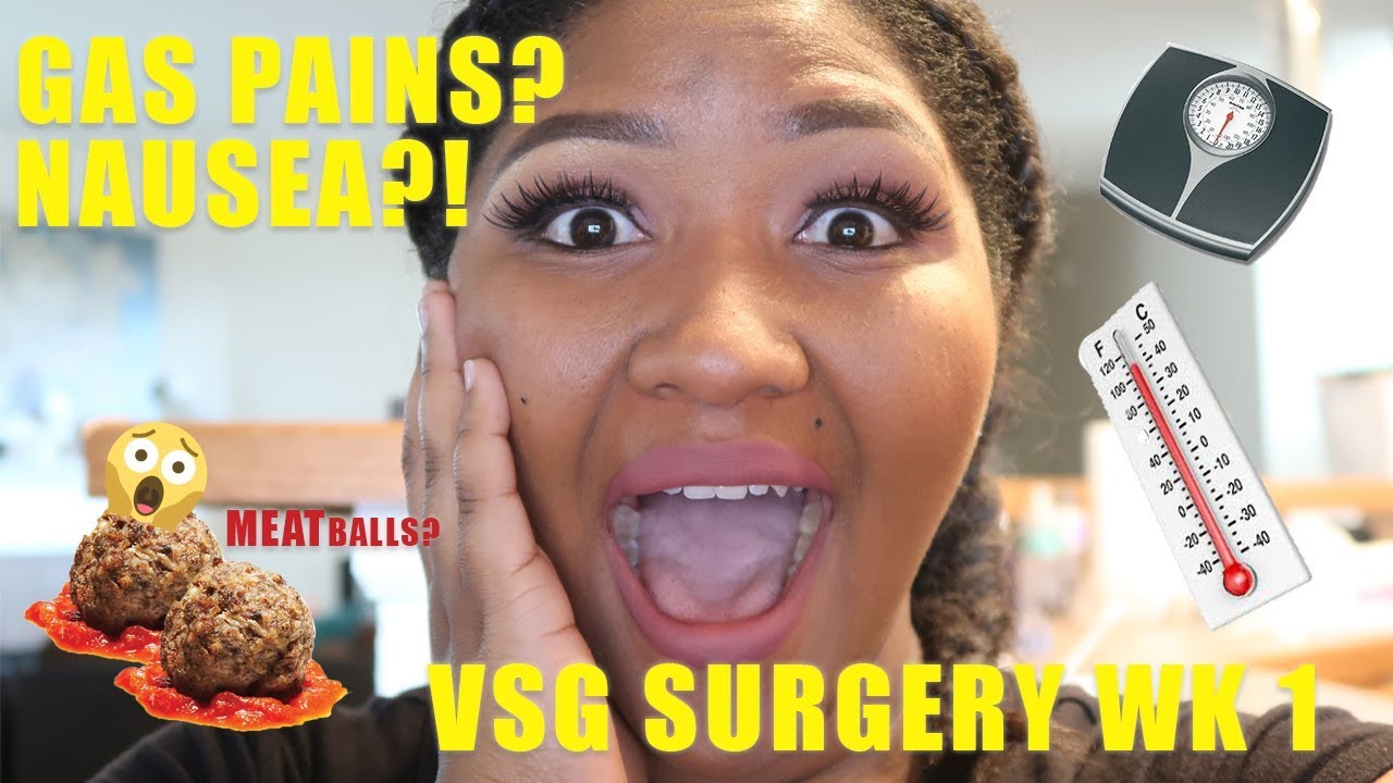 Vertical Sleeve Gastrectomy Surgery (VSG) Post Op | Week 1| How I'm Feeling!!