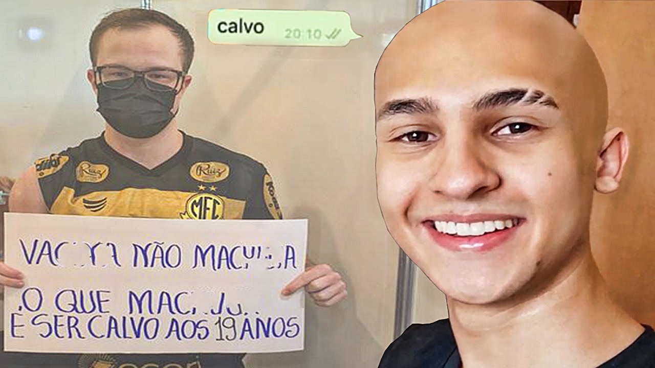 Sim, calvo aos 20 😔