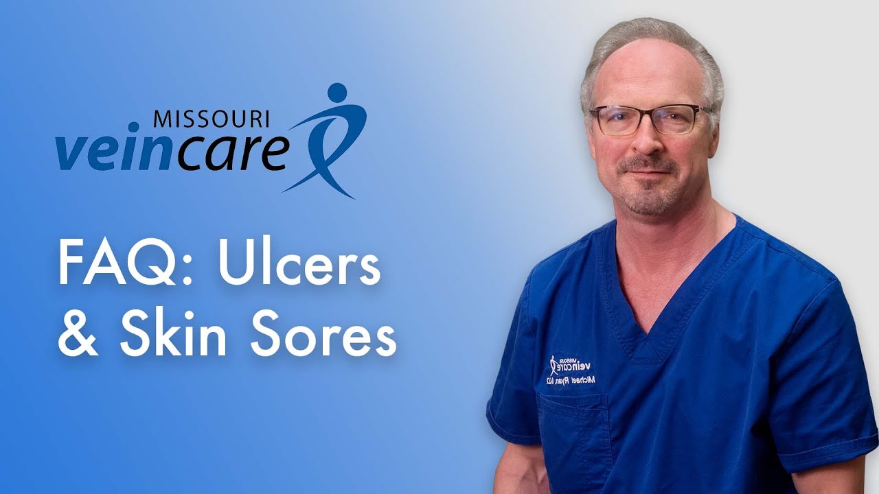 FAQ: Ulcers & Skin Sores