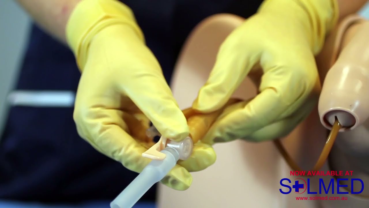 HOW TO USE THE EZ-FLOW CATHETER VALVE WITH FOLEY CATHETER - Solmed Pty Limited