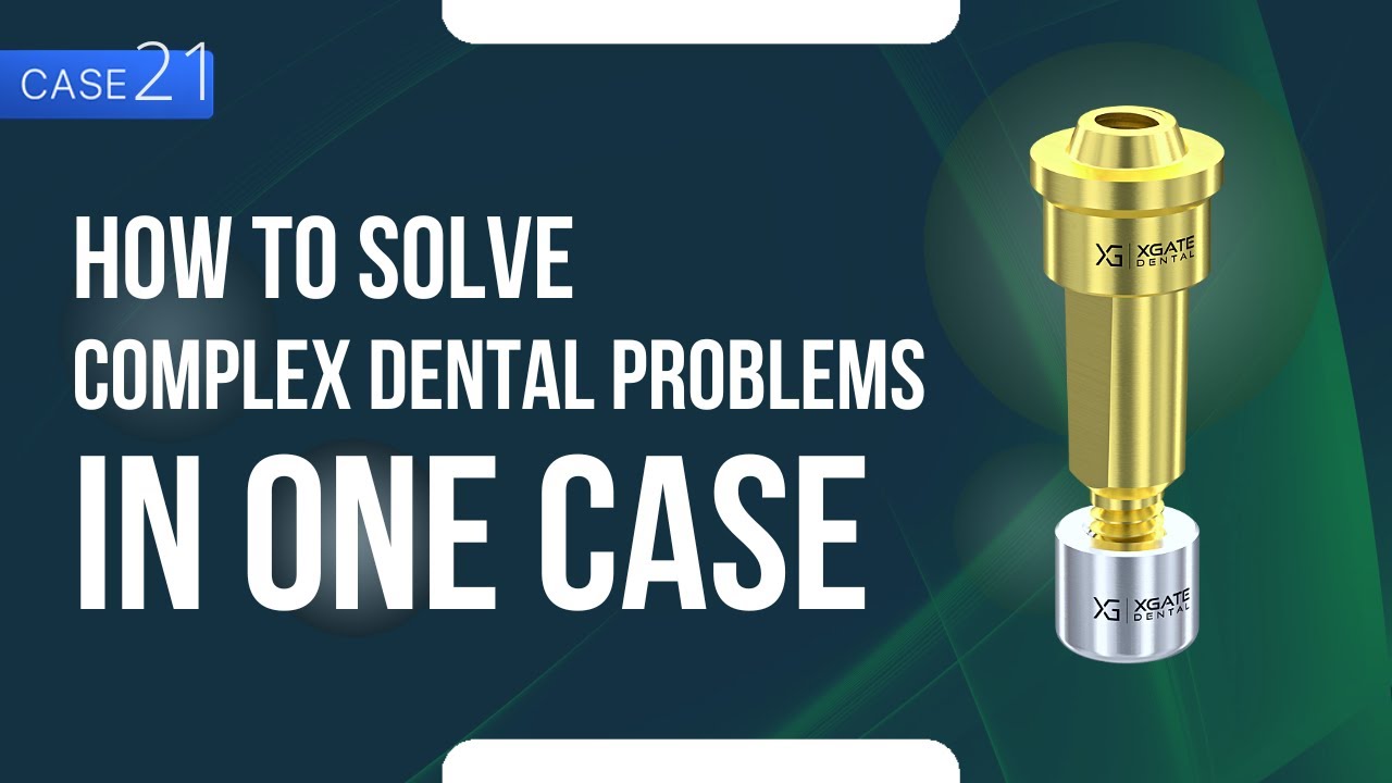 Complex Dental Case: Inflammation, Different Height and Size of Teeth, PFM Bridge, Caries and...