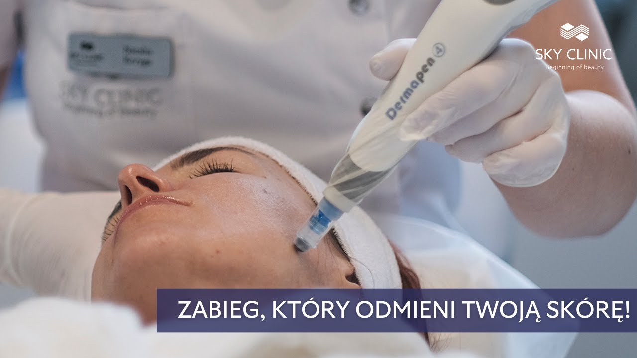 Bestsellerowy zabieg na twarz - Dermapen - efekty, zalecenia, spos&oacute;b na idealną cerę