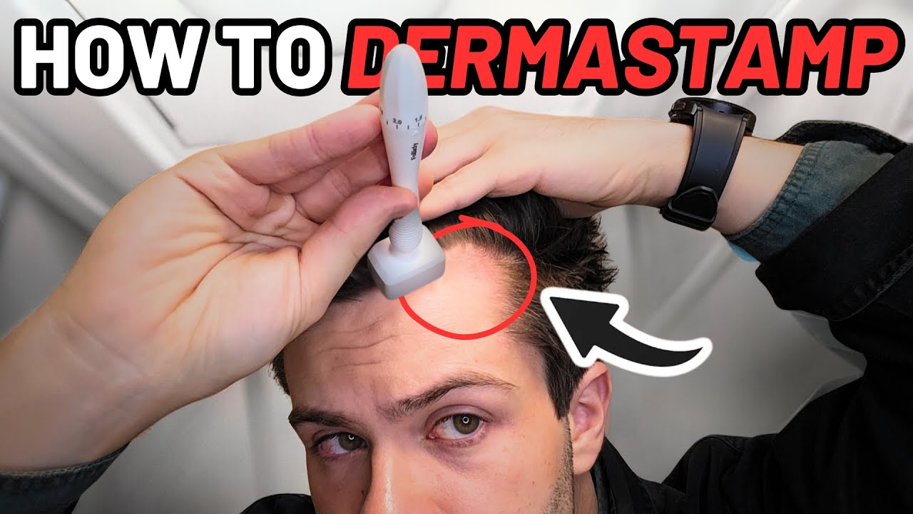 How to Derma Stamp for Quickest Hair Results (Step-by-Step Guide)