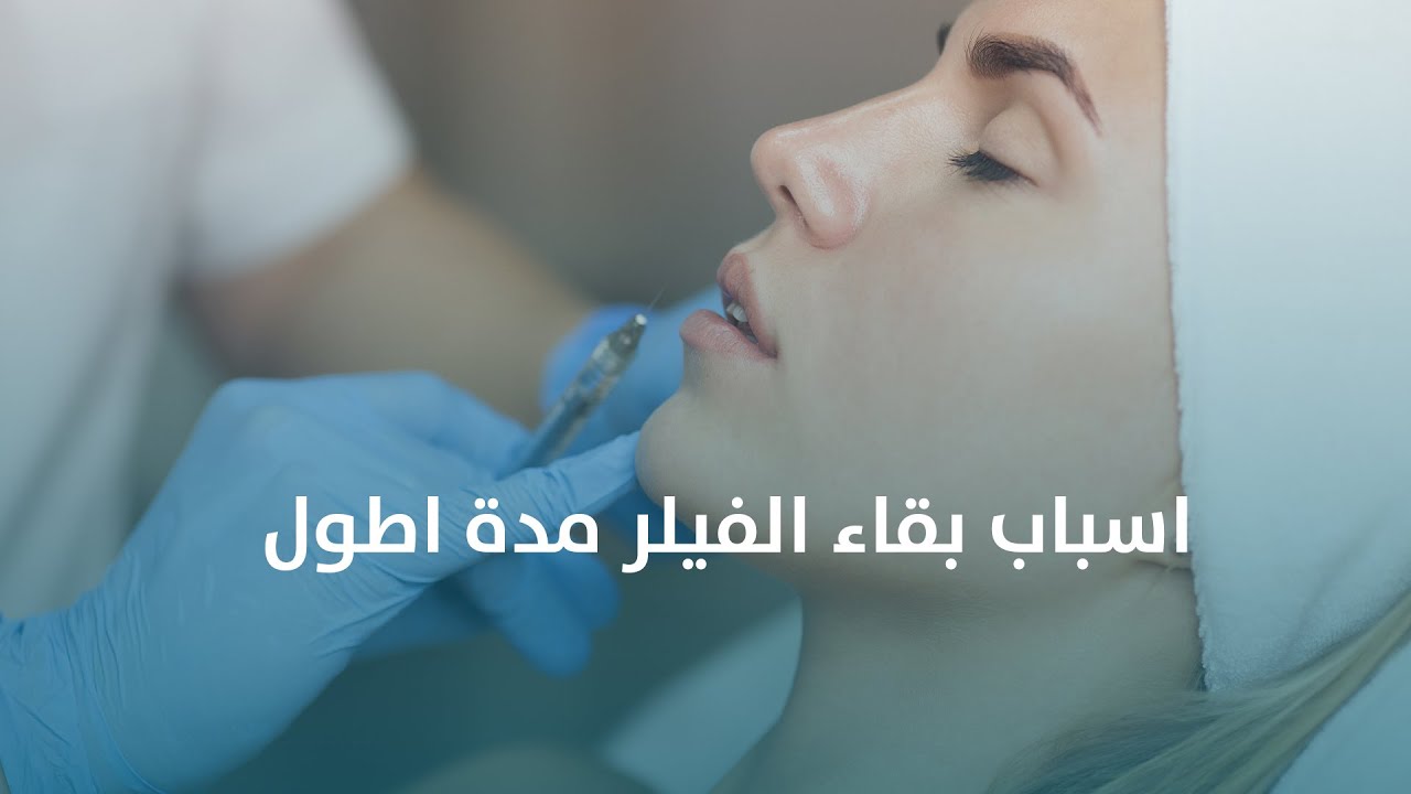 اسباب بقاء الفيلر مدة اطول