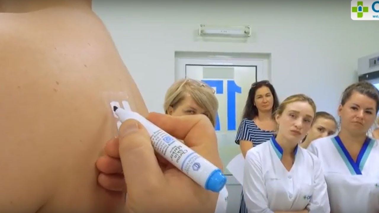 Презентация патч-тест диагностики