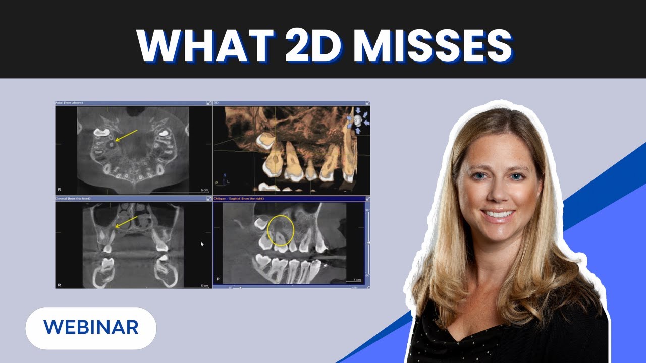 What You’re Missing Without CBCT