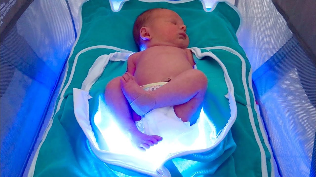 UNEXPECTED NEWBORN TREATMENT!