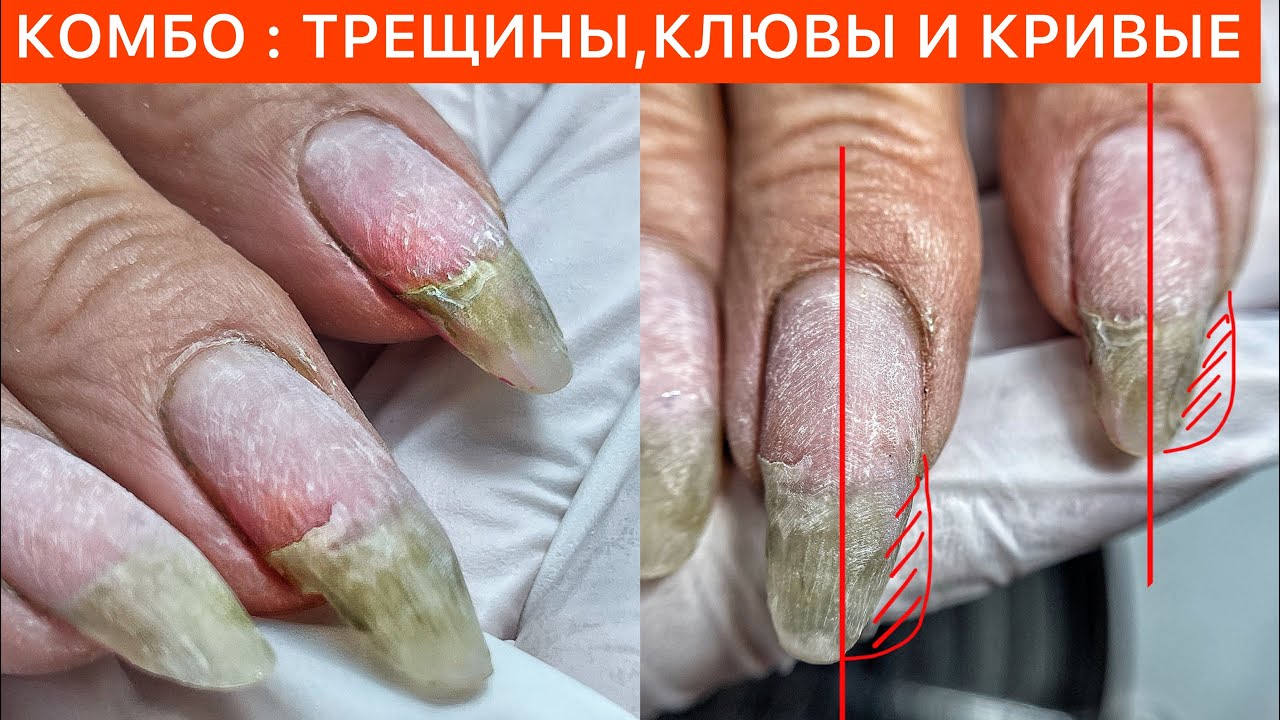 ПОЛНАЯ РЕСТАВРАЦИЯ🚨ВЕРХНИЕ ФОРМЫ + ГЕЛЬ +СТЕКЛОВОЛОКНО ⚠️ТМ NailApex 🧐🤍