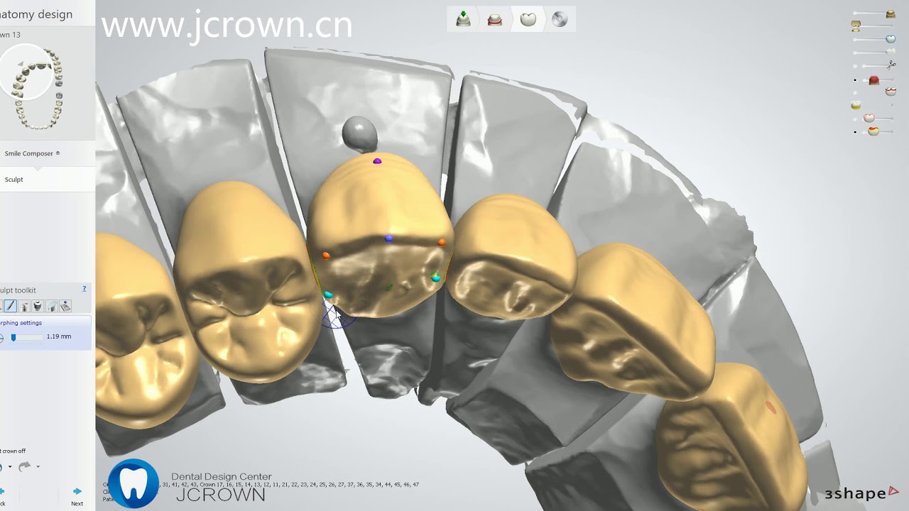 3shape-Complete Denture (full mouth) Design