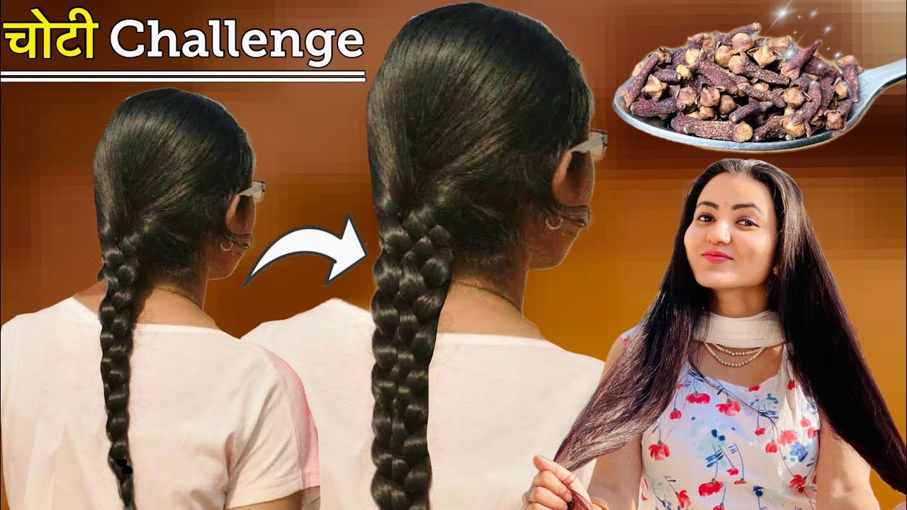 पतले टूटते बेजान बालों में बालों में डाले एक नई जान - 100% नए बाल उगाएँ | DIY Hair Growth Toner❤️