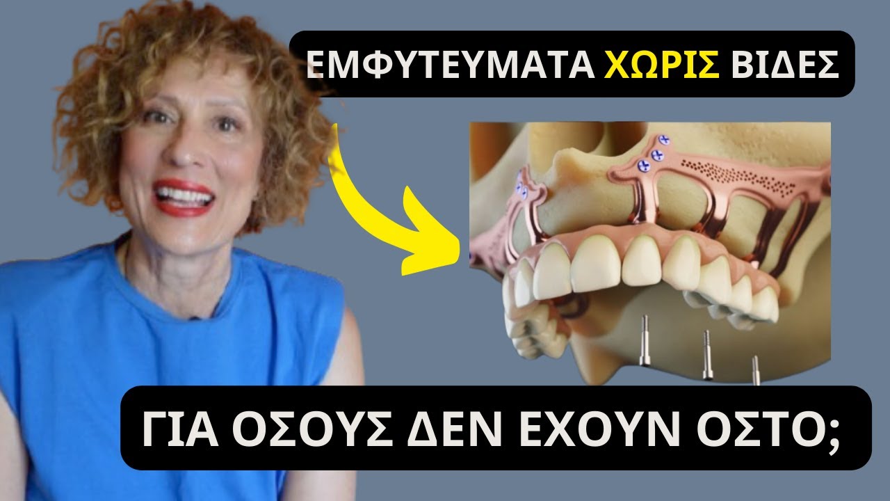 Εμφυτεύματα χωρίς βίδες; Μύθος ή πραγματικότητα;