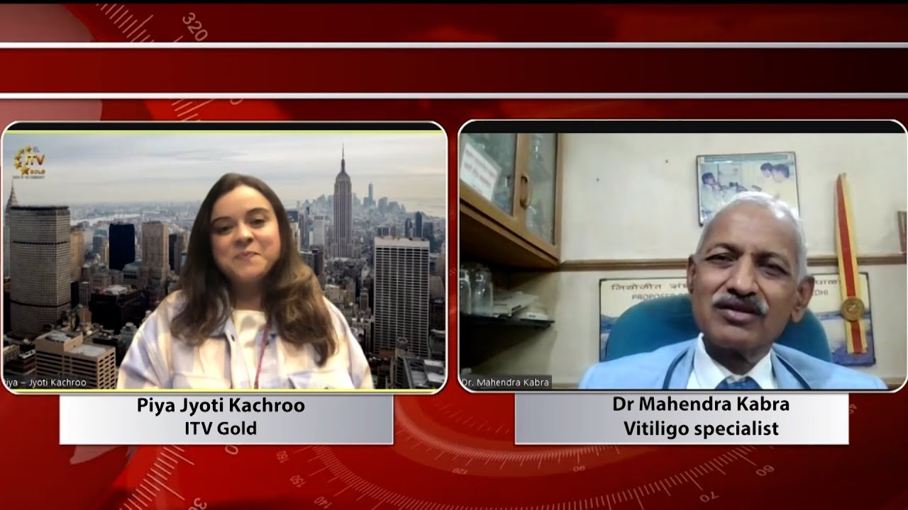 Face to Face with Dr. Mahendra Kabra, Vitiligo Specialist
