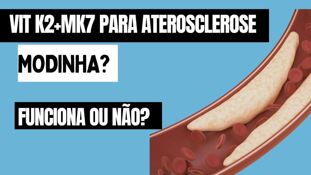 A Vitamina K2 ajuda mesmo a tirar cálcio das coronárias?