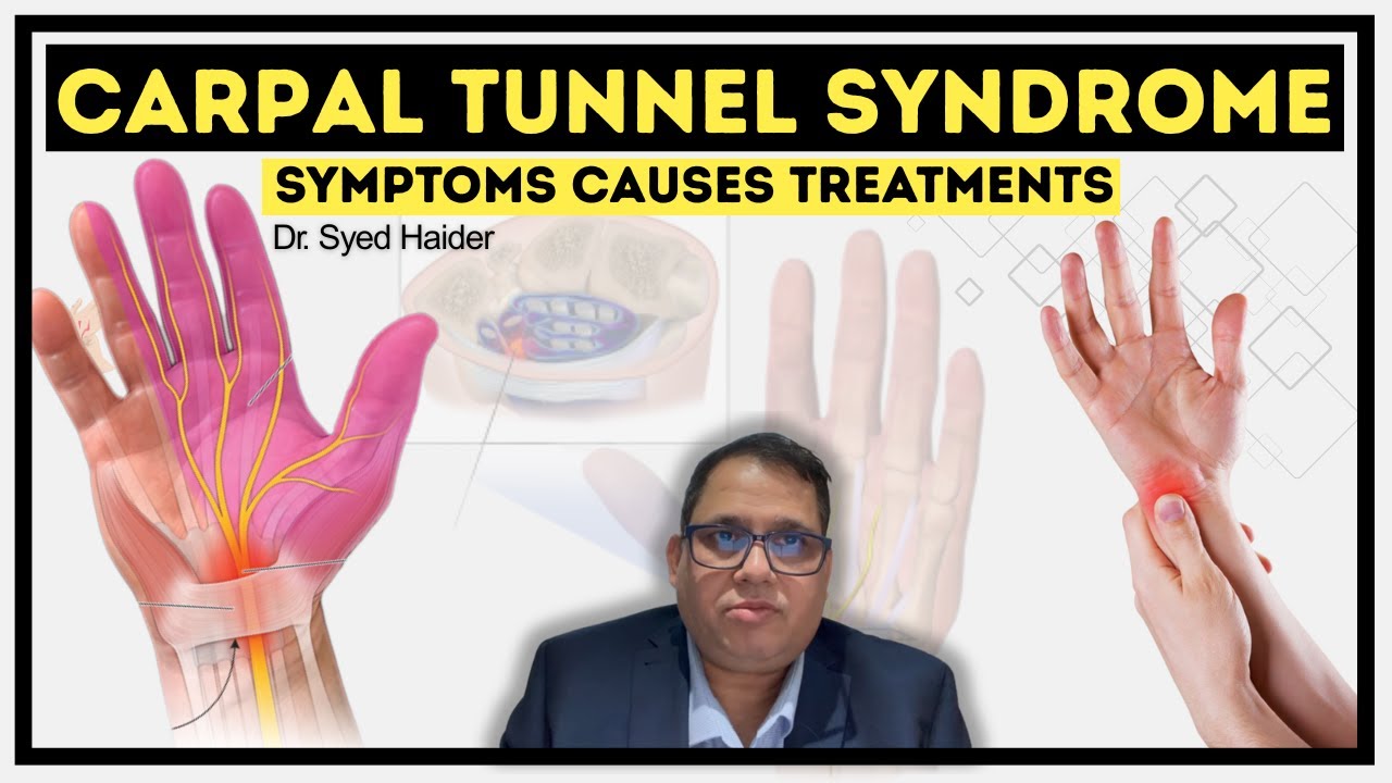 #carpal tunnel syndrome#carpaltunnelrelief#carpaltunnel #carpaltunnelsyndrome #carpaltunnel