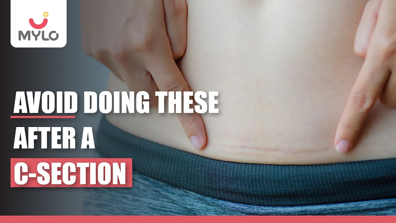 C-Section Tips | Things To Avoid After A Cesarean Delivery