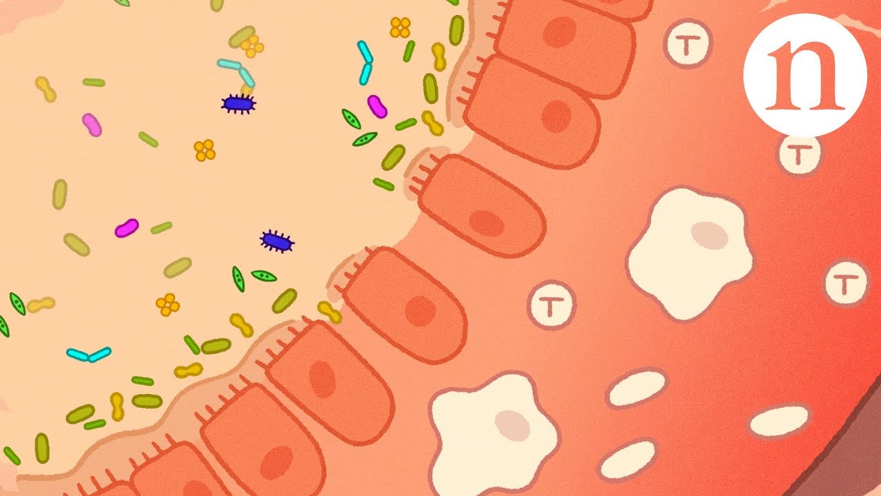 Ulcerative colitis: Fresh approaches to taming inflammation