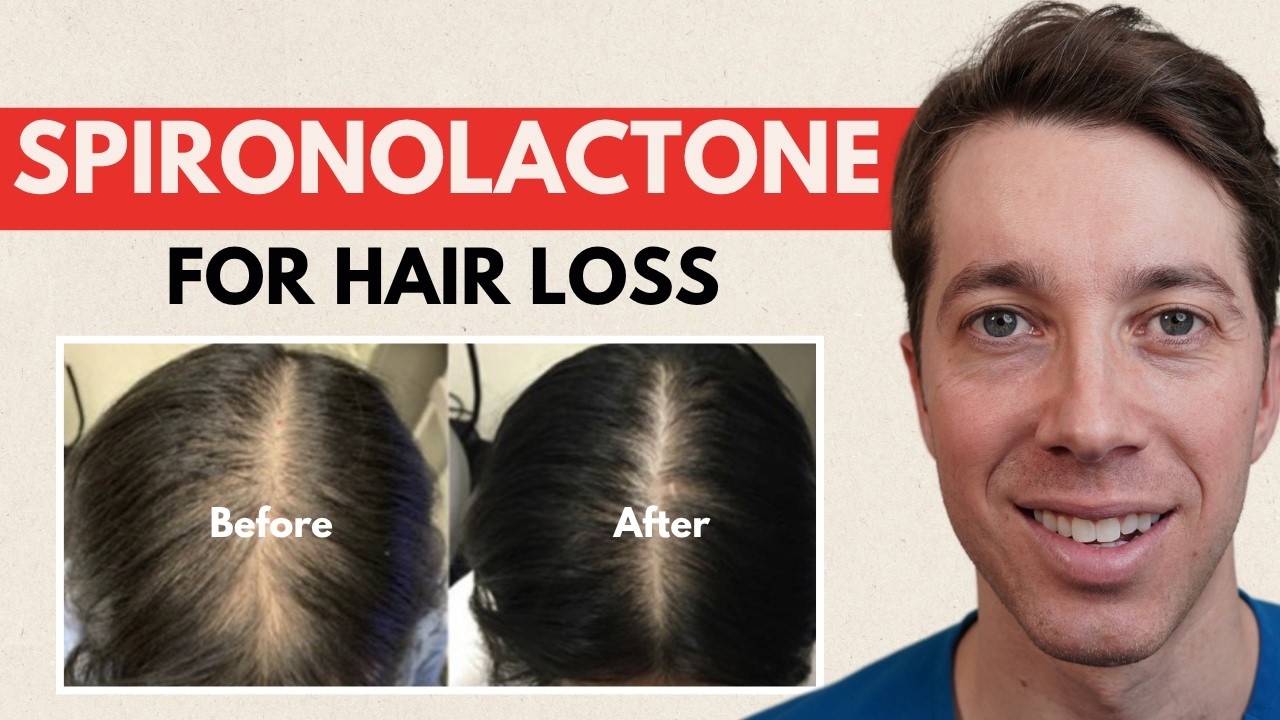 Spironolactone for Hair Loss – The Real Results & What to Expect
