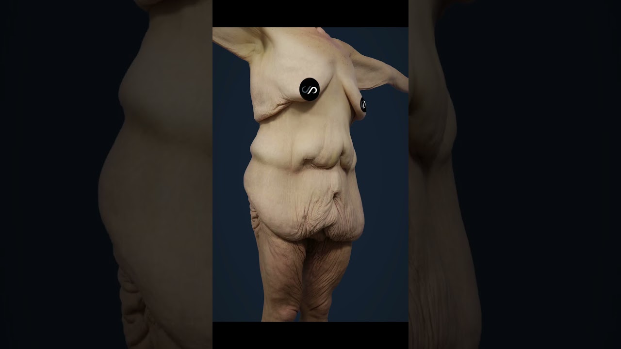 Extreme Bikini Body Lift Transformation in 60 Seconds 