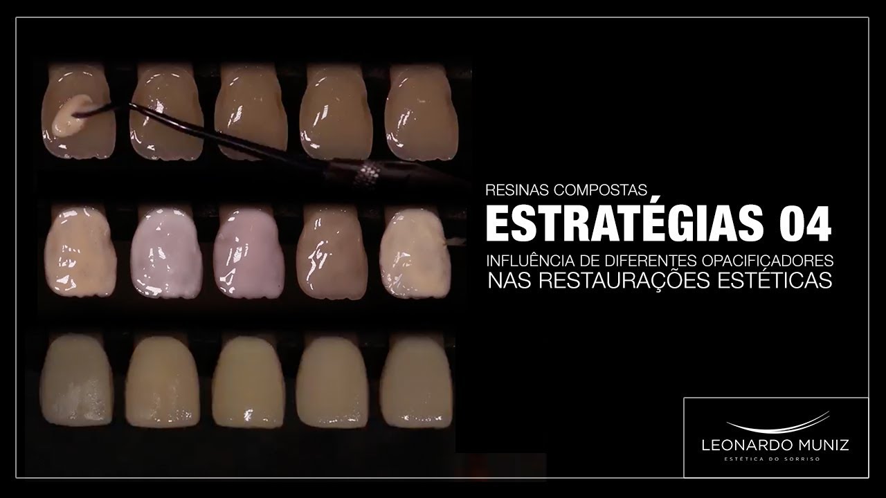 Resinas Compostas: Estratégias 04 Influencia de Diferentes Opacificadores nas Restaurações Estéticas