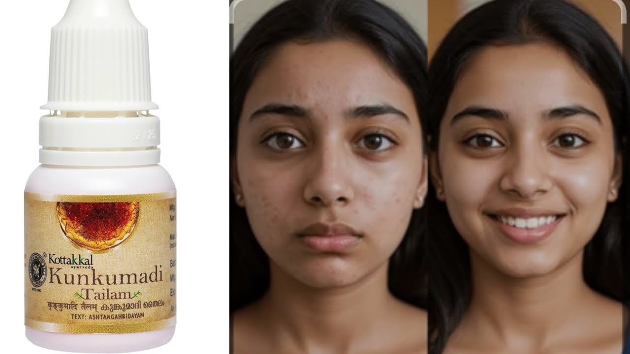 How to apply Kumkumadi thailam on face || kumkumadi thailam kottakal arya vaidya sala 💎💎