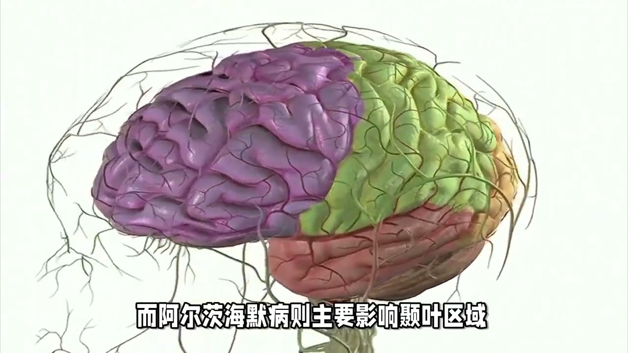 健康与疾病中的记忆迷思：触屏任务揭示阿尔茨海默病独特特征