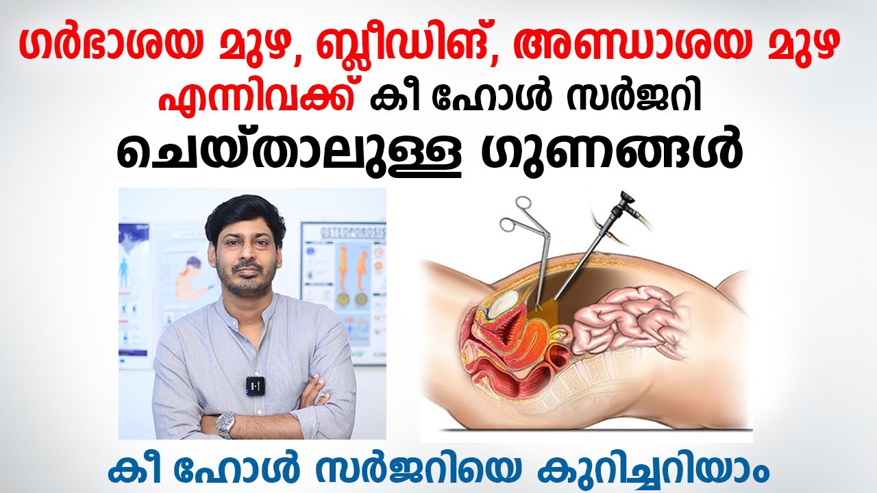 ഗർഭാശയ മുഴ, ബ്ലീഡിങ്, അണ്ഡാശയ മുഴ രോഗങ്ങളും കീ ഹോൾ സർജറിയും | Know about Keyhole Surgery