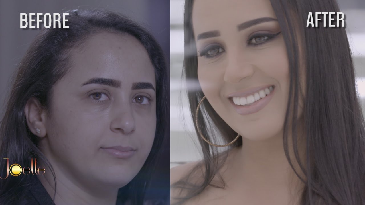 عندما نتحدى ظروف الحياة بالإرادة القوية .. دورساف ضيفة الحلقة في برنامج جويل .