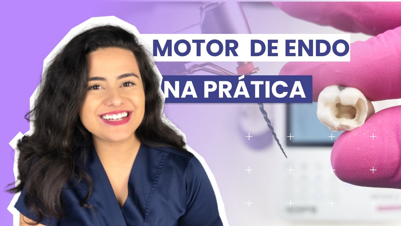 Motor Endodontia: Reciprocante e Rotatório na Prática