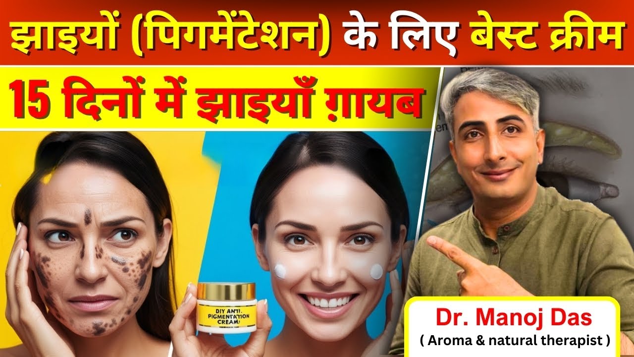झाइयां खत्म करने की क्रीम | Jhaiya Khatam Karne Ki Cream I DR. MANOJ DAS I #drmanojdas