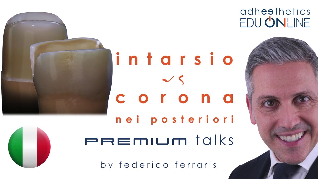 Intarsio vs corona nei posteriori_Trailer_Premium talks_Adhesthetics Edu online