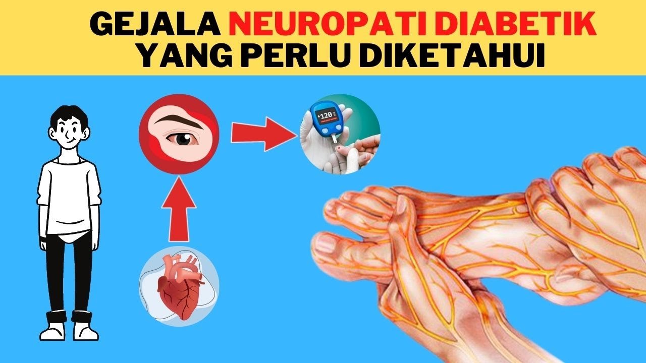 6 Gejala Neuropati Diabetik yang Sering Tidak Disadari