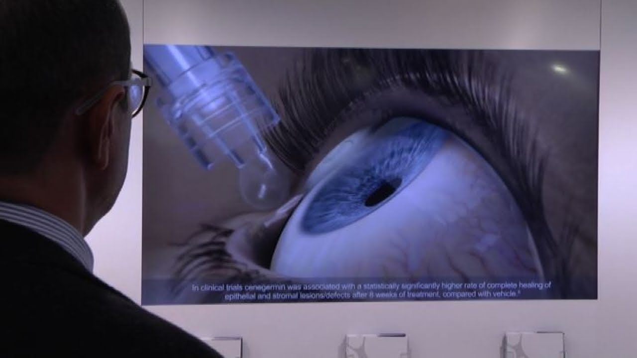 Nuovo trattamento per migliorare vita di chi soffre di glaucoma