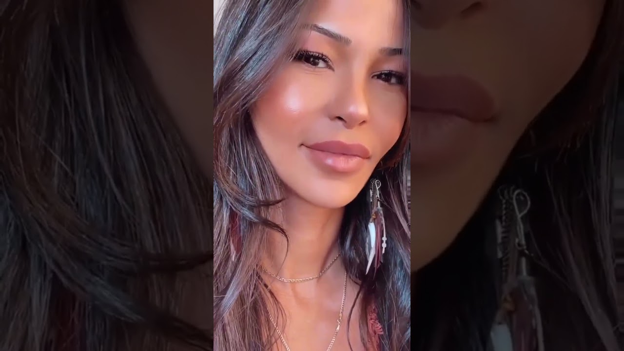 3 MONTHS AFTER REVISION RHINOPLASTY