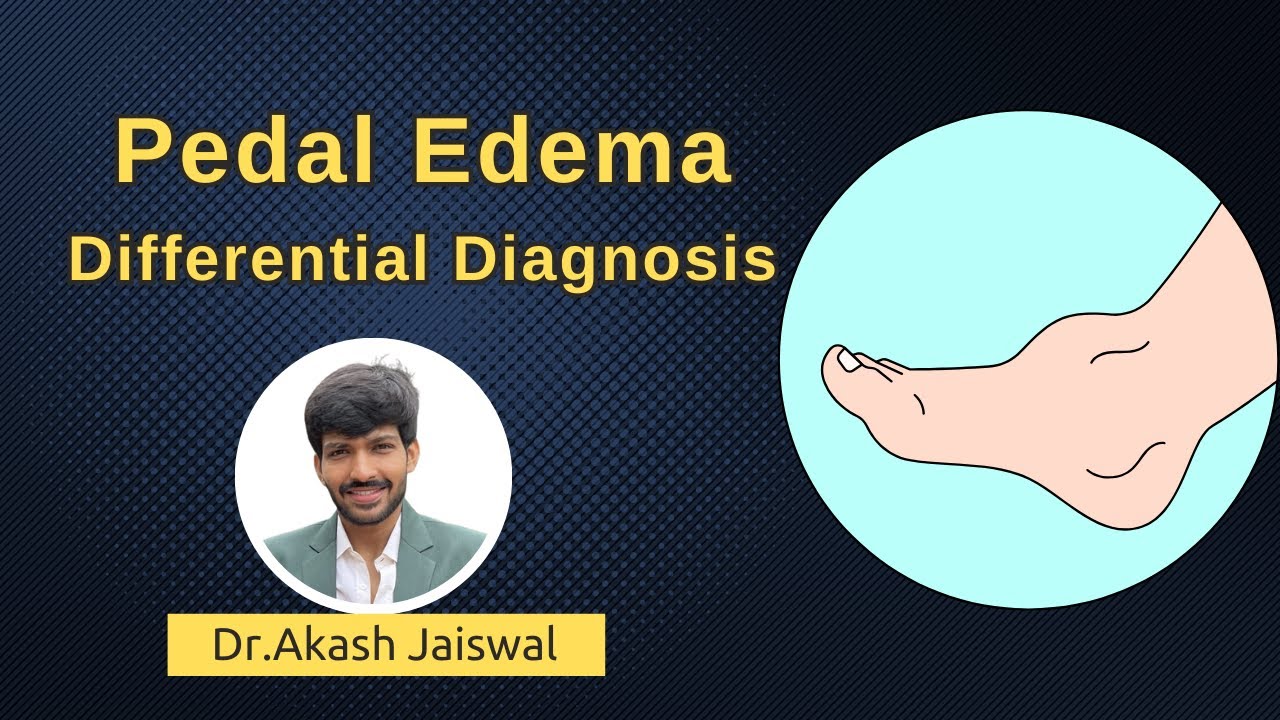 Pedal Edema - Differential Diagnosis
