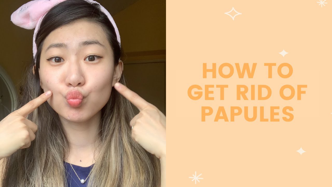 How to Get Rid of Papules | FaceTory