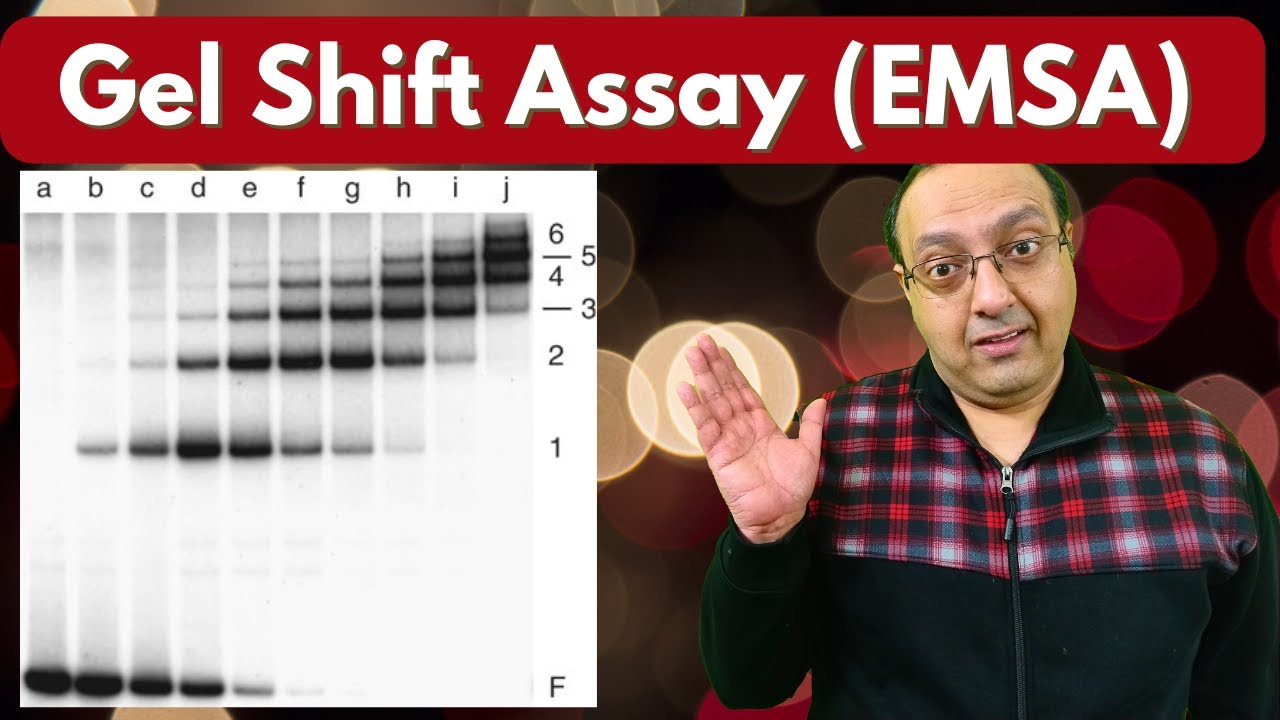 Gel Shift Assay (EMSA) - Principle and Applications