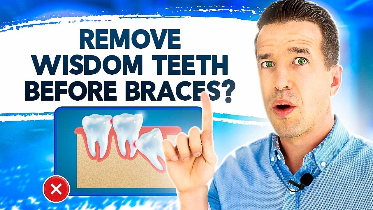Do Wisdom Teeth Make Your Teeth Crooked?