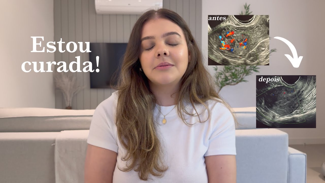 Abrindo meu coração: Tudo que aconteceu e a cura!