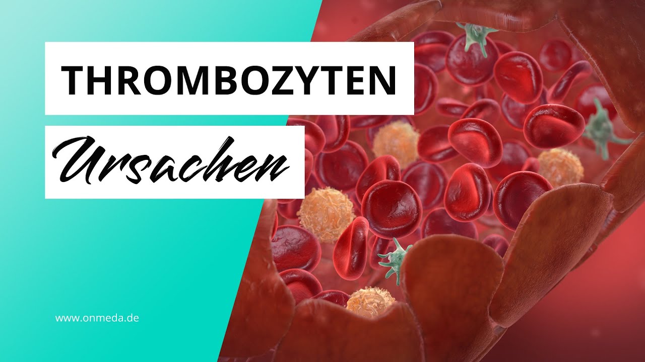 Thrombozyten zu hoch? M&ouml;gliche Ursachen