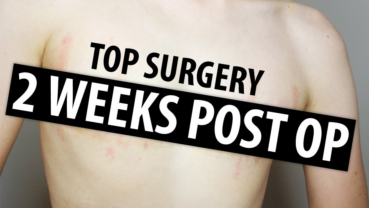 2 Weeks Post Op (Dr. Garramone) | Nonbinary Top Surgery