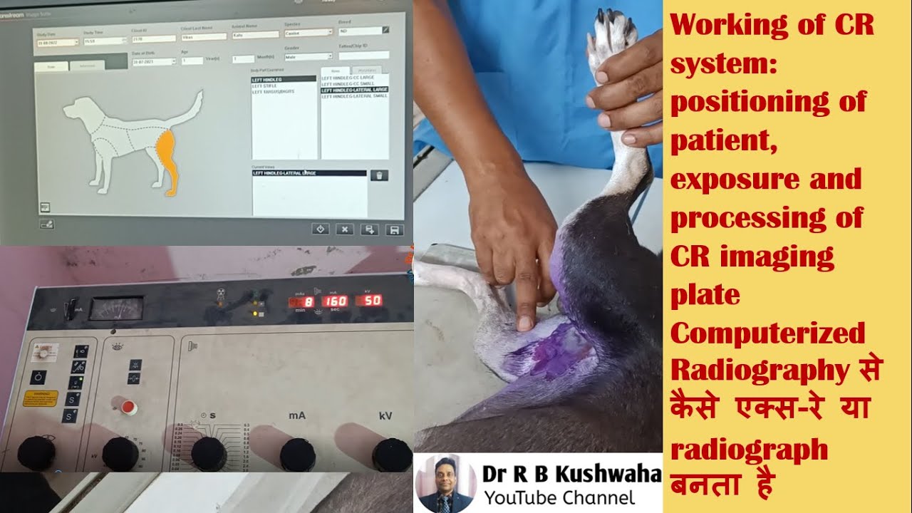 How to take X-ray and processing of CR cassette: positioning, X-rays exposure and CR working system
