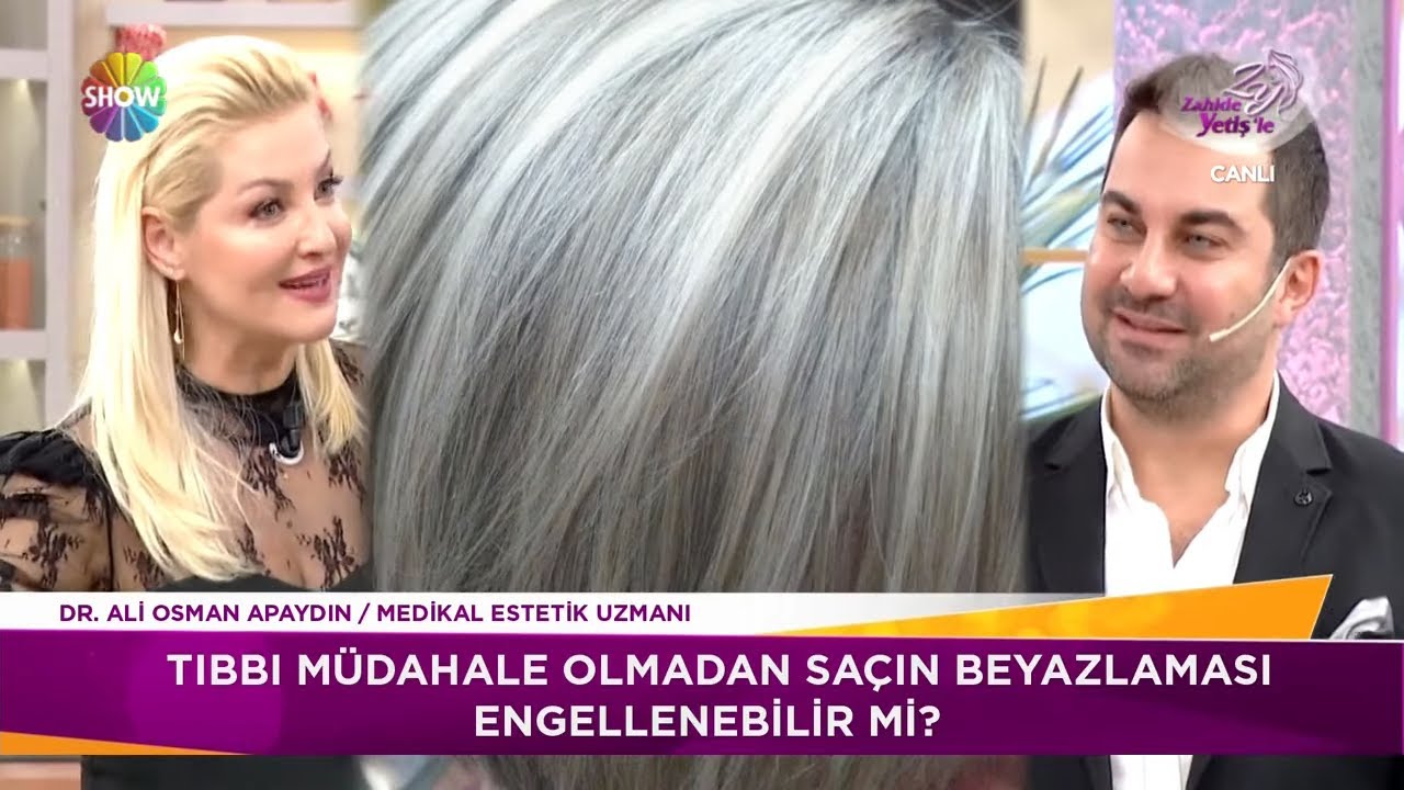 Saç beyazlaması engellenebilir mi?