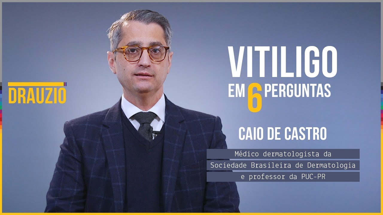 Vitiligo em 6 perguntas | Caio de Castro