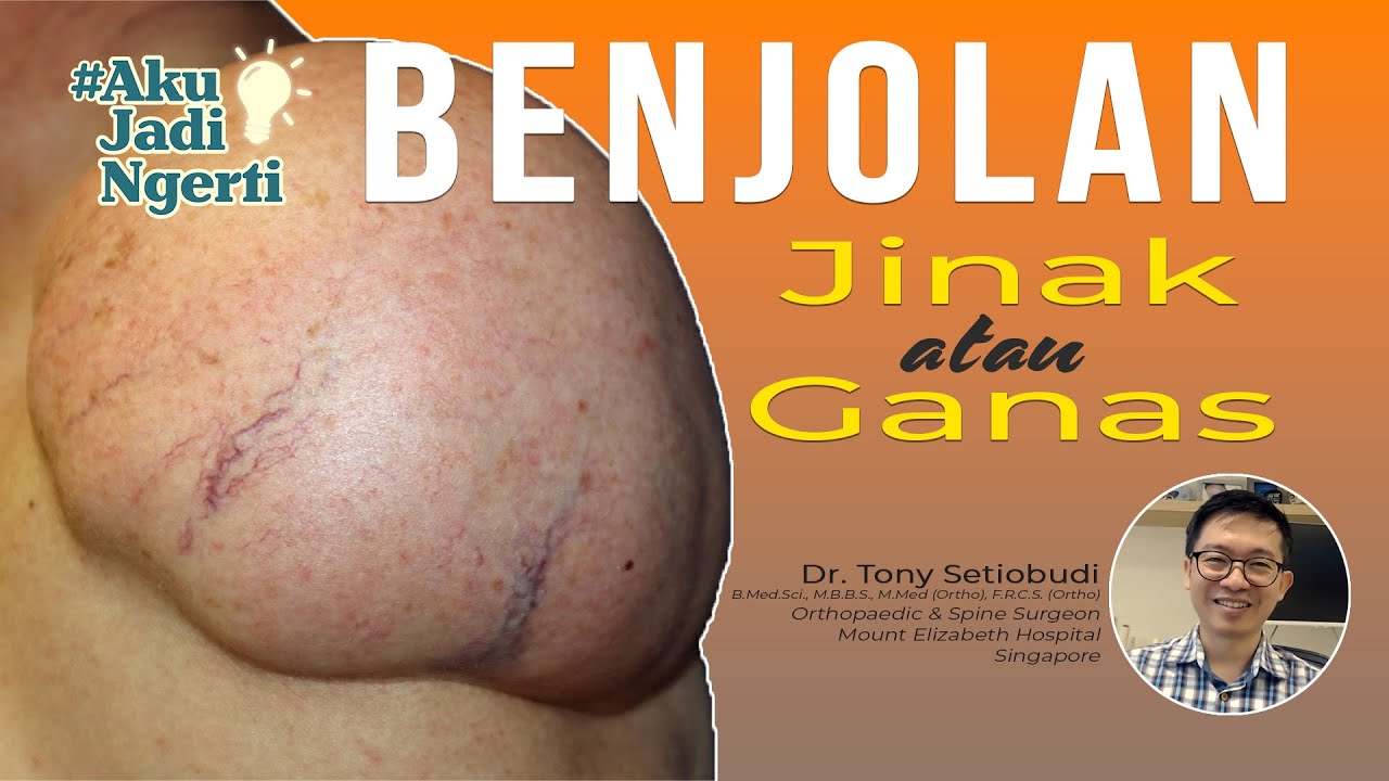 BENJOLAN A-Z. JINAK VS GANAS. Dr. Tony Setiobudi