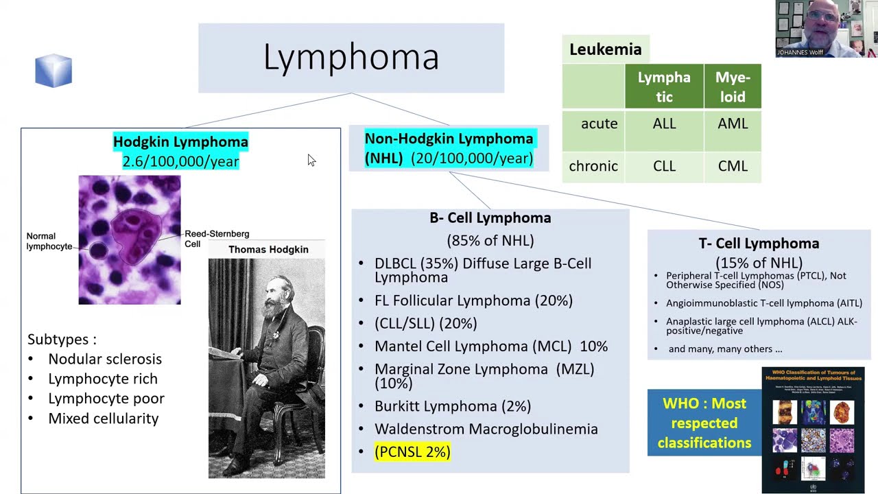 PCNSL response criteria explained