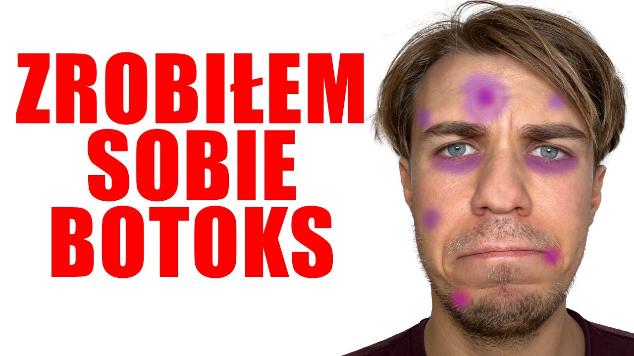 SZKOŁA - ALE MAM 12 LAT I ZROBIŁEM BOTOKS