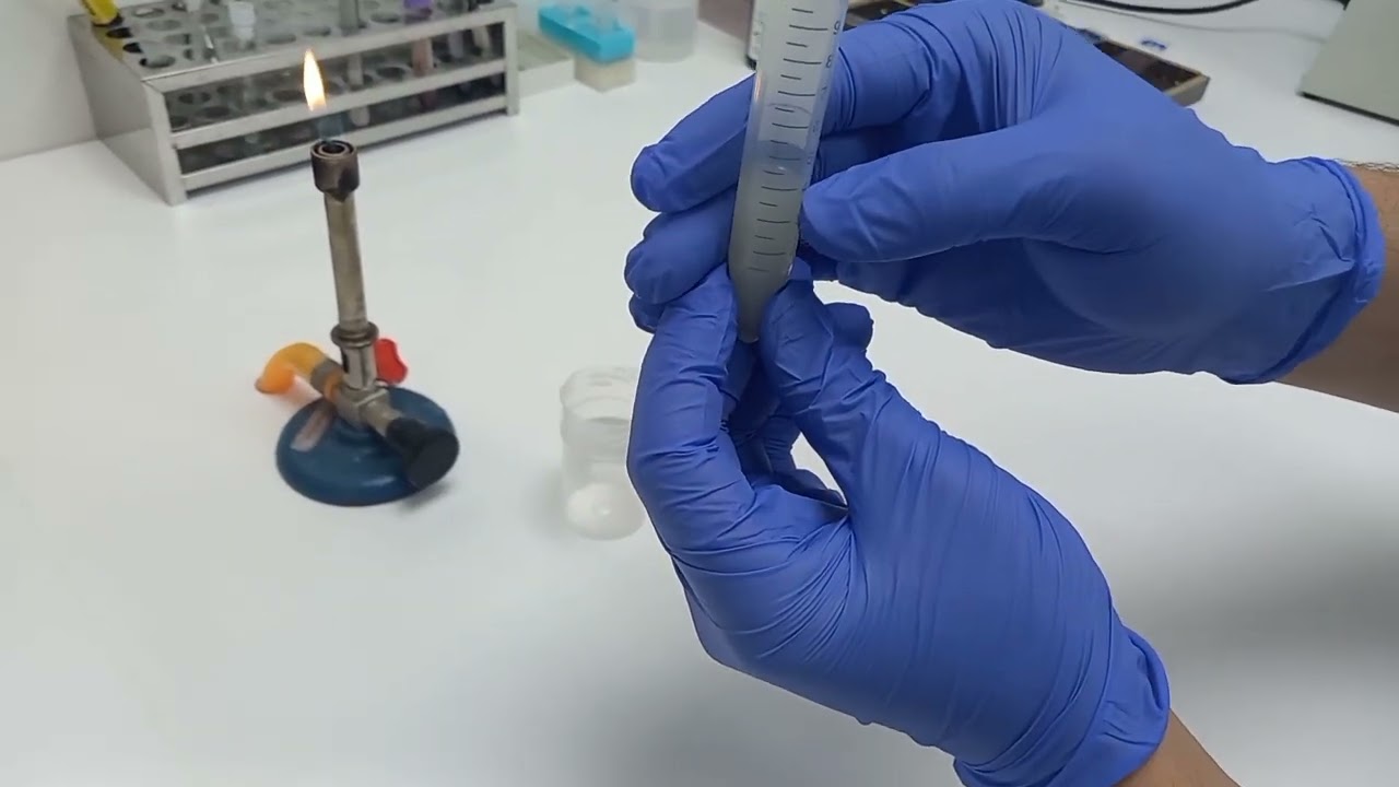 Spermoculture # قراءة شاملة لتحليل السائل المنوي مع شرح مبسط